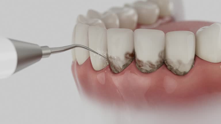 Reliable Dental contractor in Beechwood, MI by Dentist Open Now